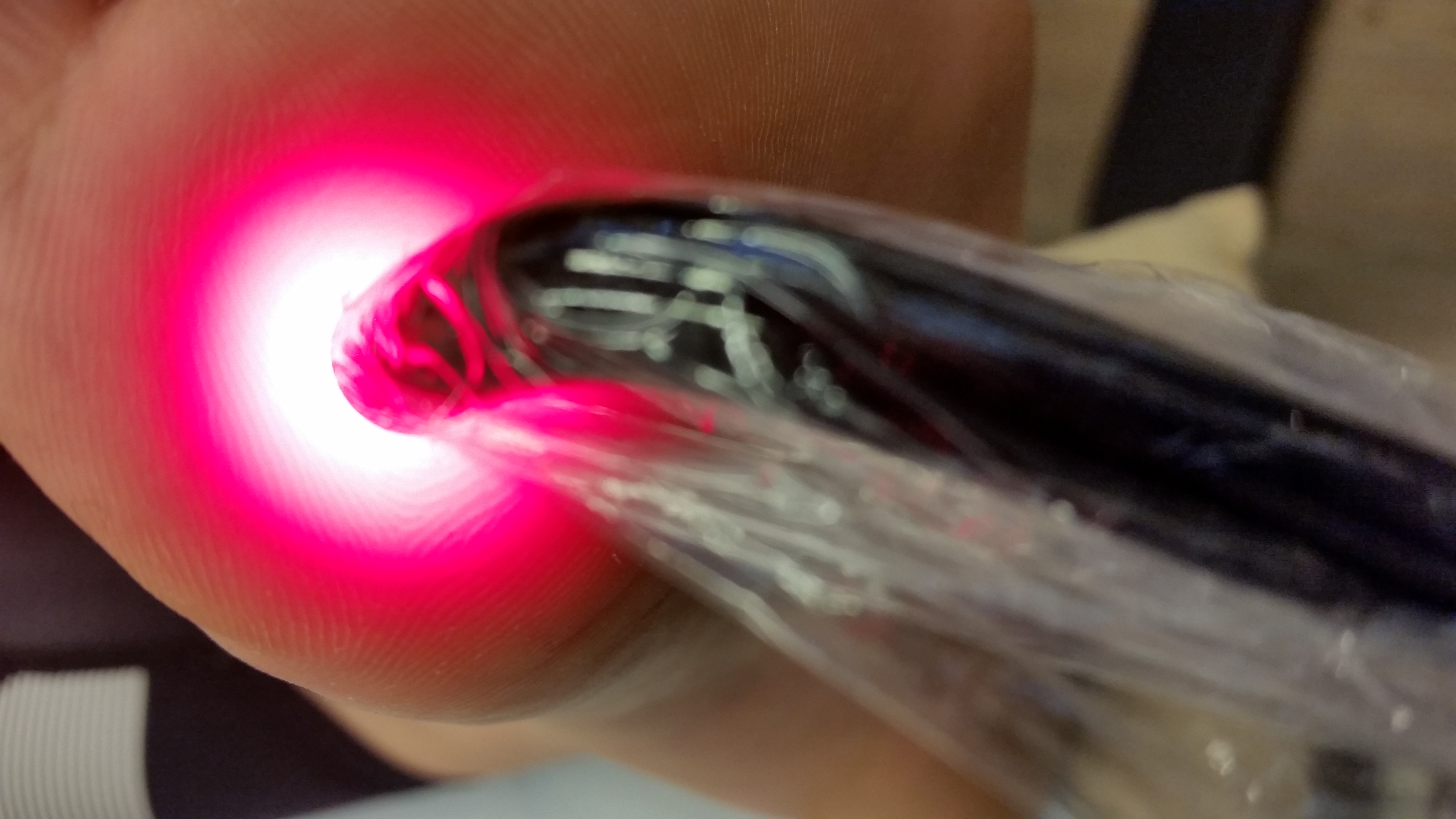 Fotvorte behandlet med medisinsk laser